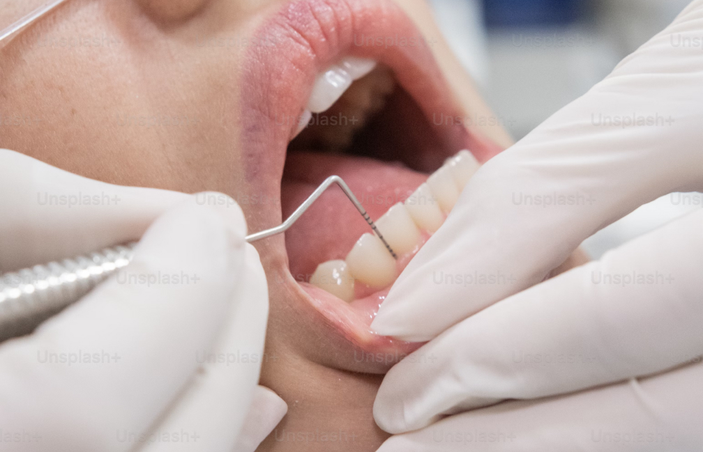 savigny le temple soins racines Portal Page Dentistes Essonne | Apolline Dental Care