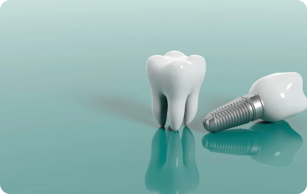 implant dentaire esonnes Implant dentaire Fontenay-le-Vicomte Dentistes Essonne | Apolline Dental Care
