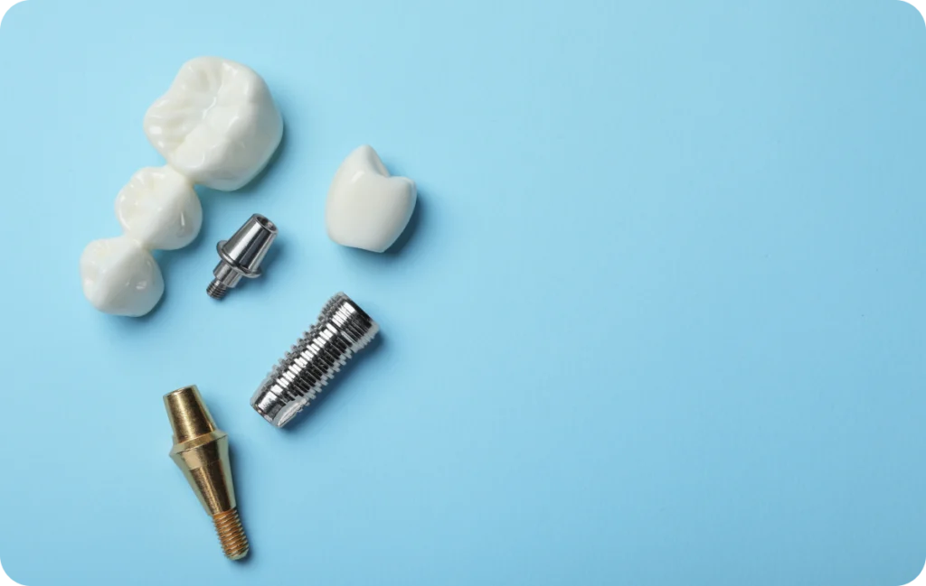 implant dentaire savigny le temple Implant dentaire Corbeil-Essonnes Dentistes Essonne | Apolline Dental Care