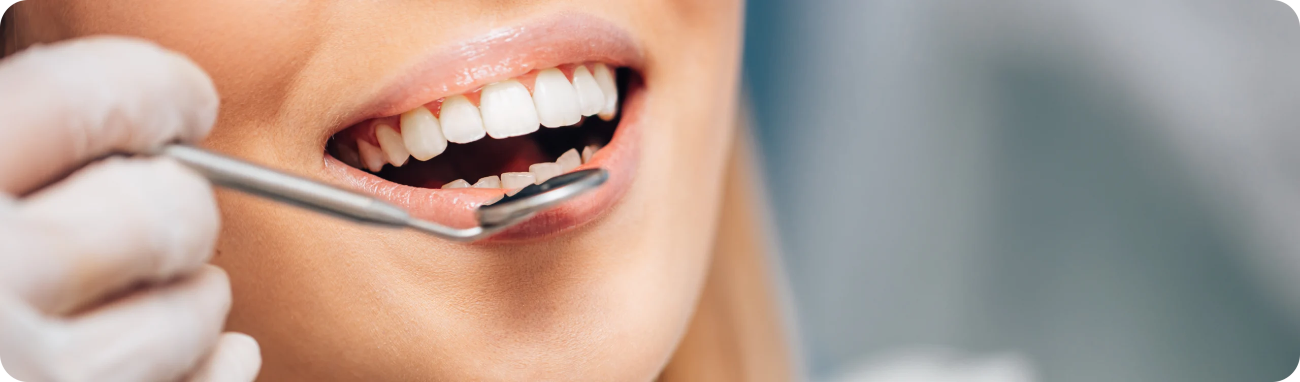 parodontologie dentistes fontenay le vicomte scaled  Dentistes Essonne | Apolline Dental Care