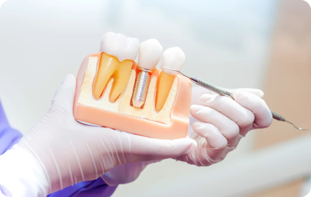 adobestock 320187109 1 adobestock 320187109 1 Implant Dentaire Dentistes Essonne | Apolline Dental Care