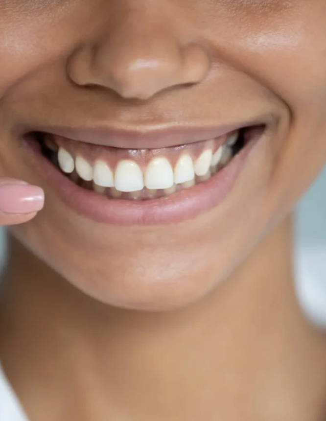 esthetique dentiste essonne Patient Dentistes Essonne | Apolline Dental Care