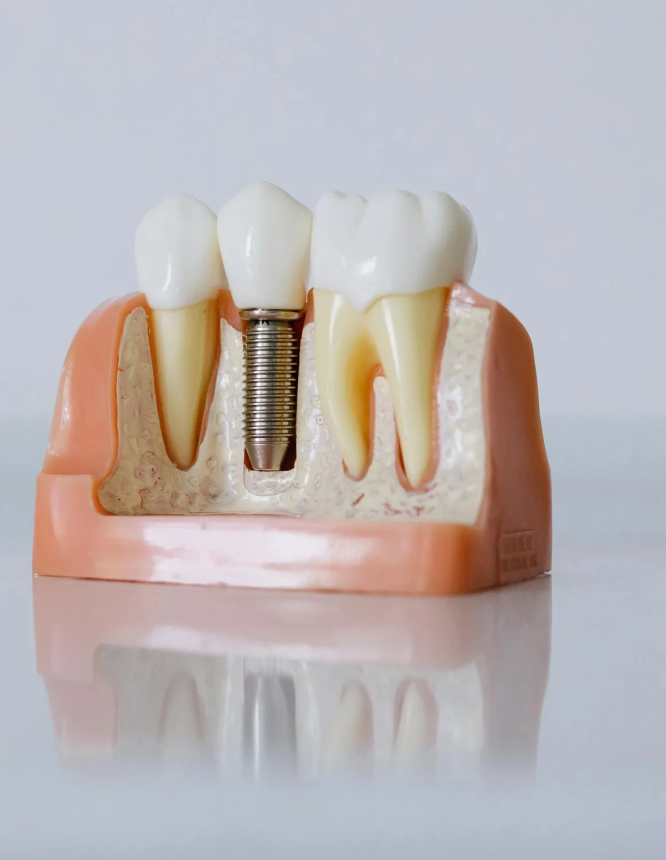 implant dentaire dentiste essonne Praticien Dentistes Essonne | Apolline Dental Care