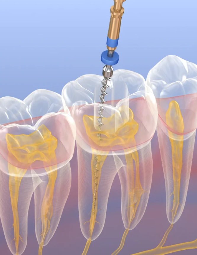 protheses dentaires dentiste essonne Praticien Dentistes Essonne | Apolline Dental Care