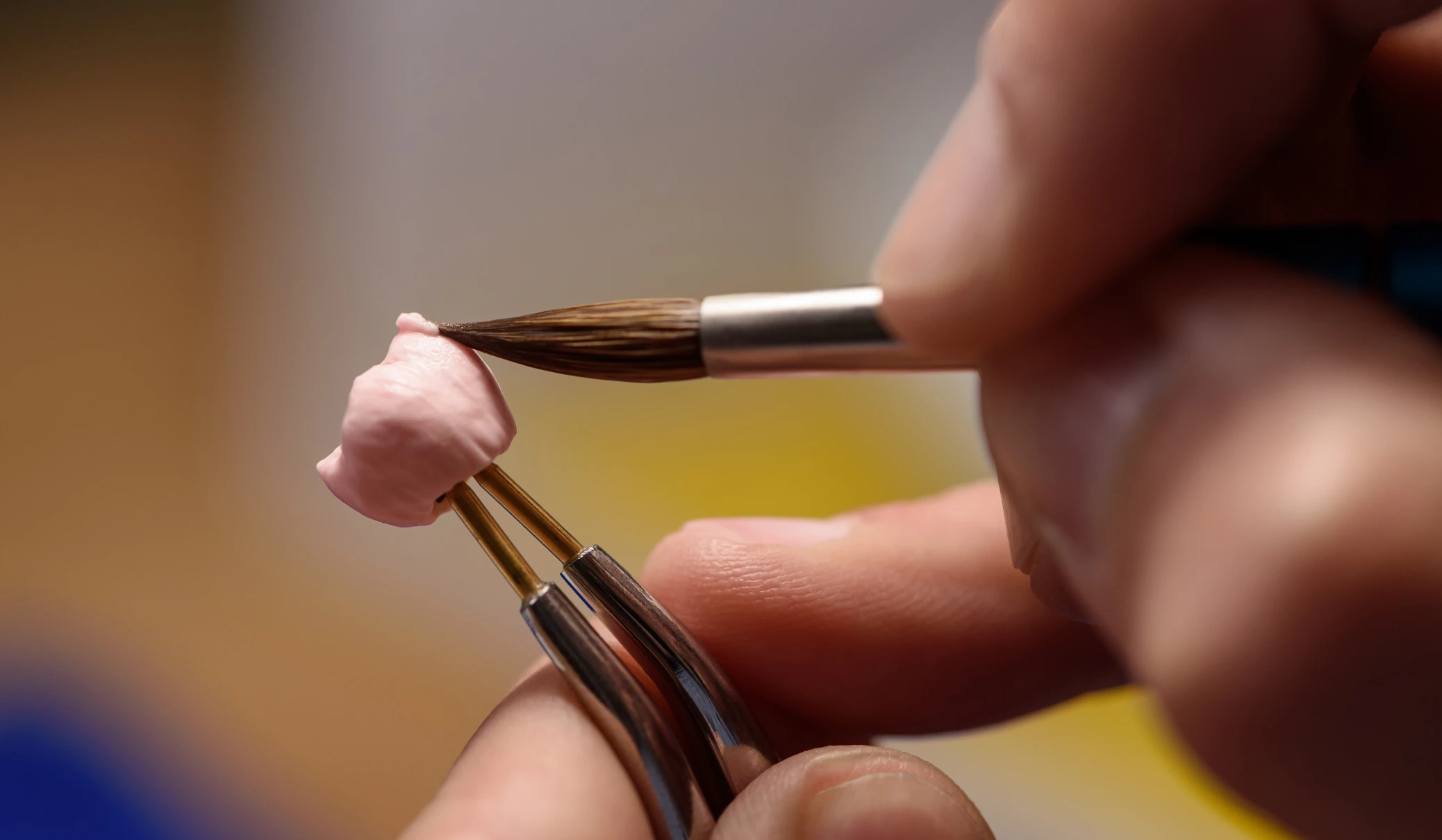 protheses dentiste essonne Patient Dentistes Essonne | Apolline Dental Care