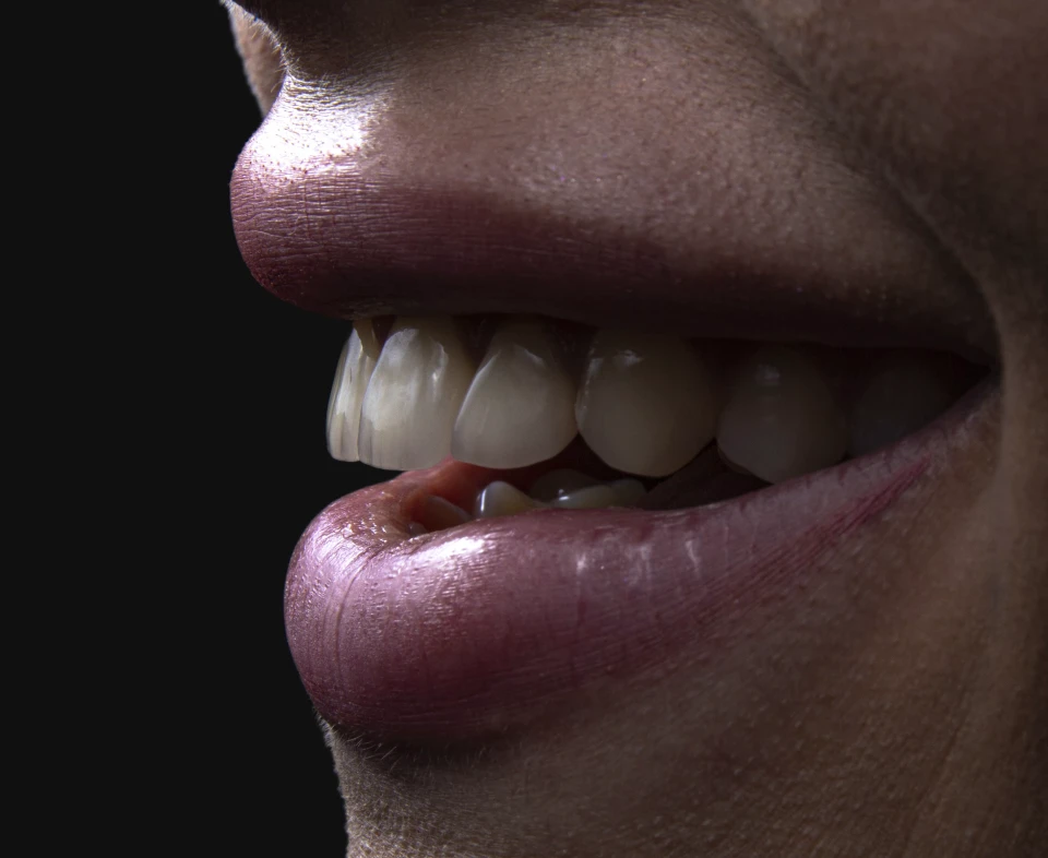technologie apolline dental care photographie Patient Dentistes Essonne | Apolline Dental Care