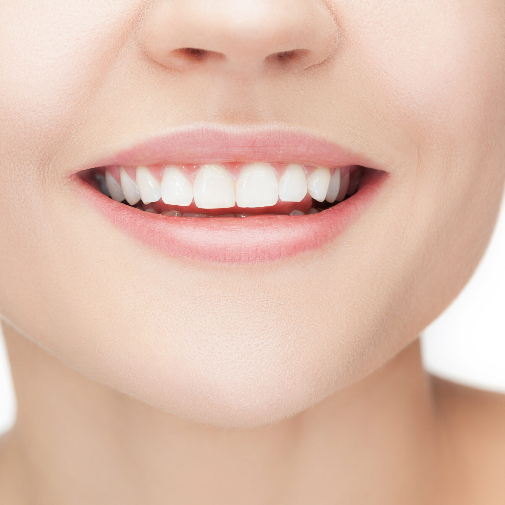 Séance de blanchiment et d’éclaircissement dentaire professionnel pour illuminer le sourire à Apolline Dental Care à Corbeil-Essonnes