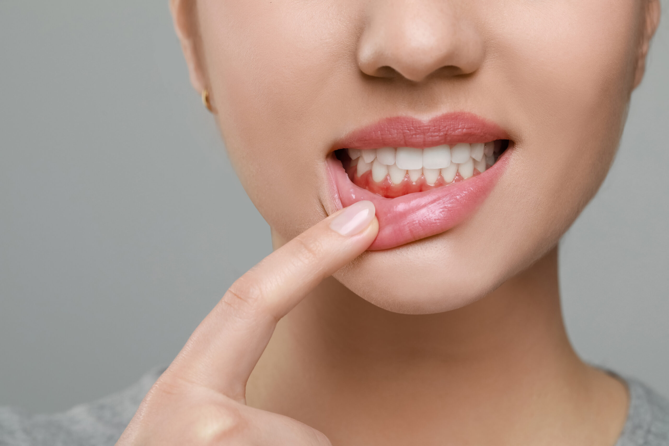 cabinet dentaire plateau technique scaled Maintenance parodontale et suivi Apolline Dental Care | Cabinet Dentaire Spécialisé