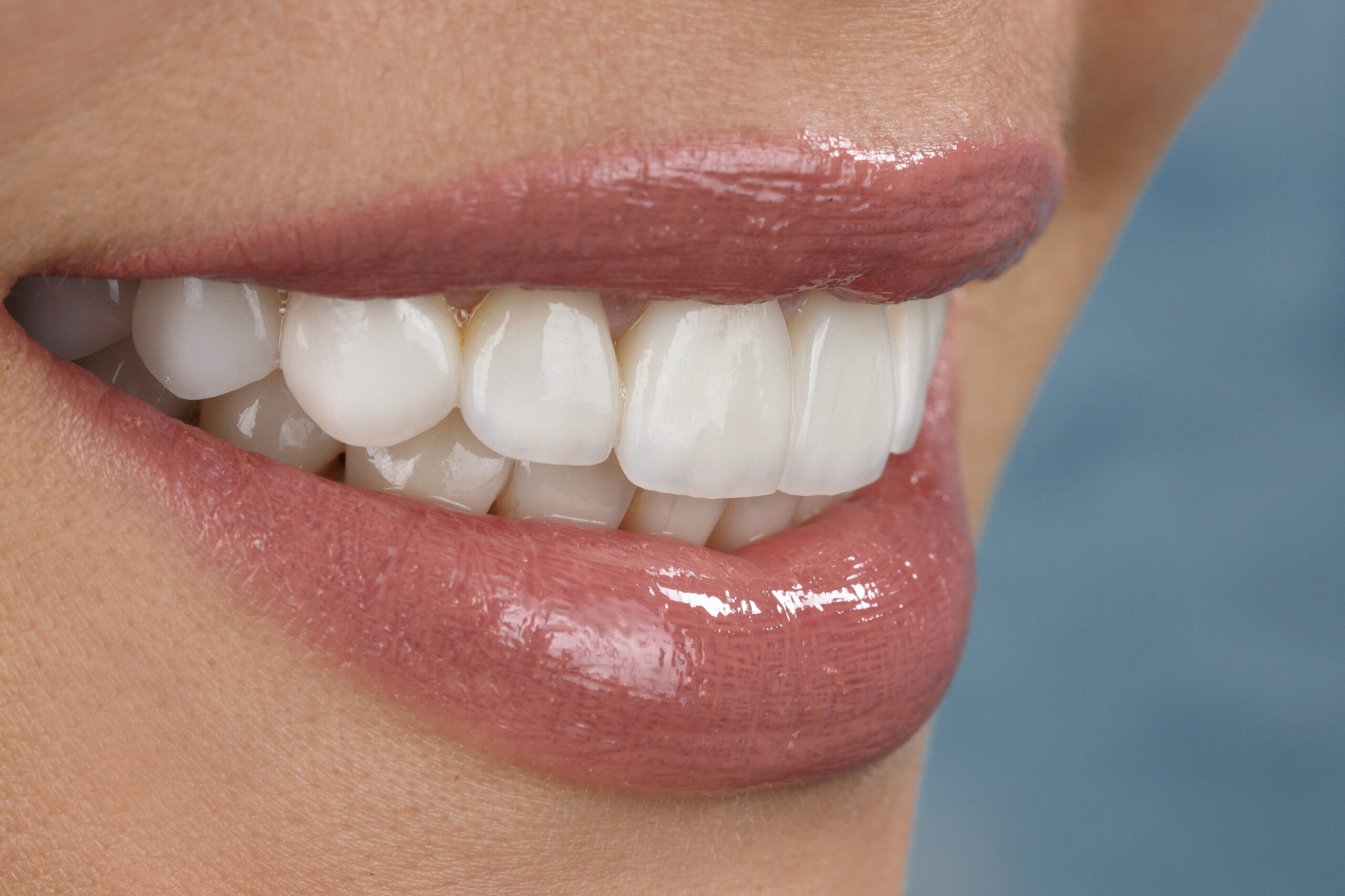 cabinet dentaire soins modernes scaled Traitements esthétiques du sourire Apolline Dental Care | Cabinet Dentaire Spécialisé