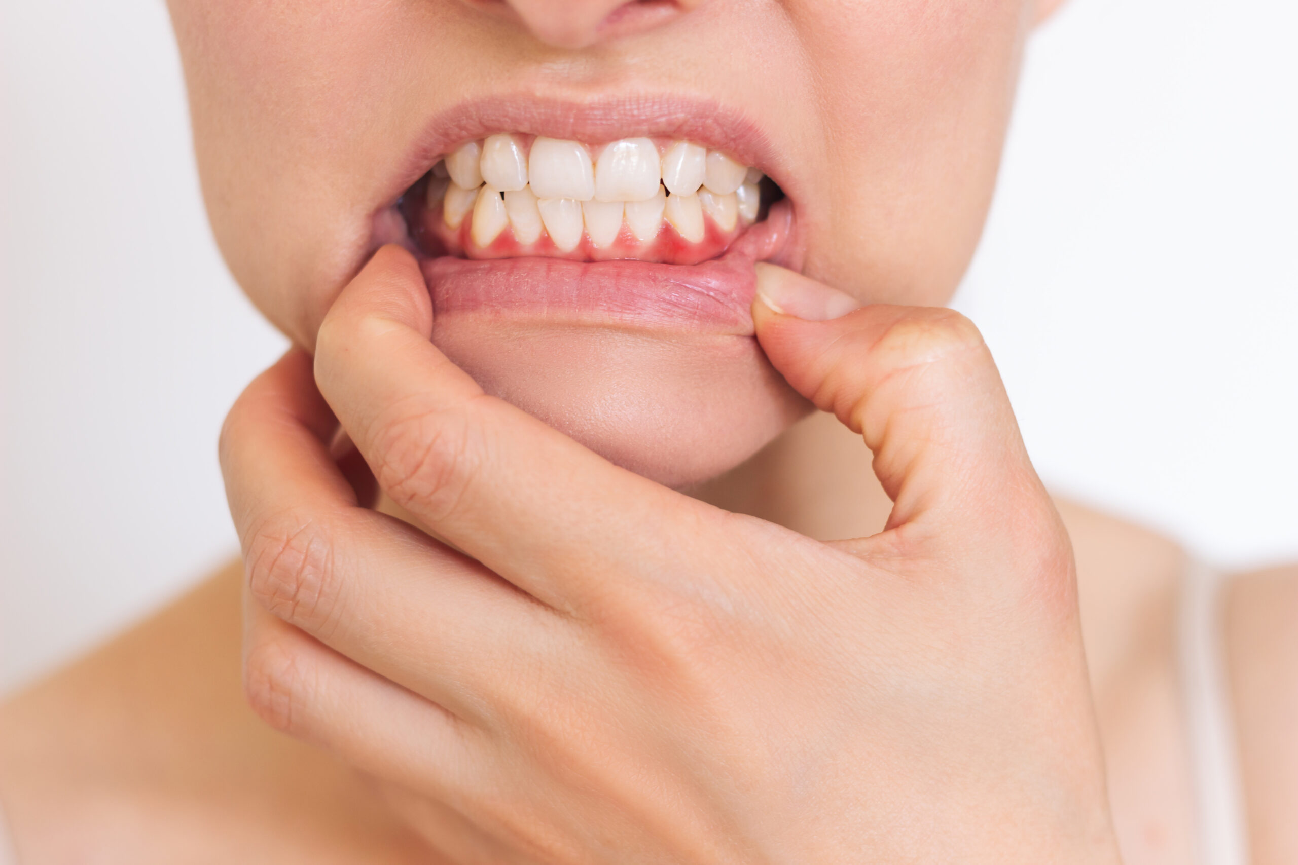 dentiste suivi sante dentaire scaled Soins parodontaux Apolline Dental Care | Cabinet Dentaire Spécialisé