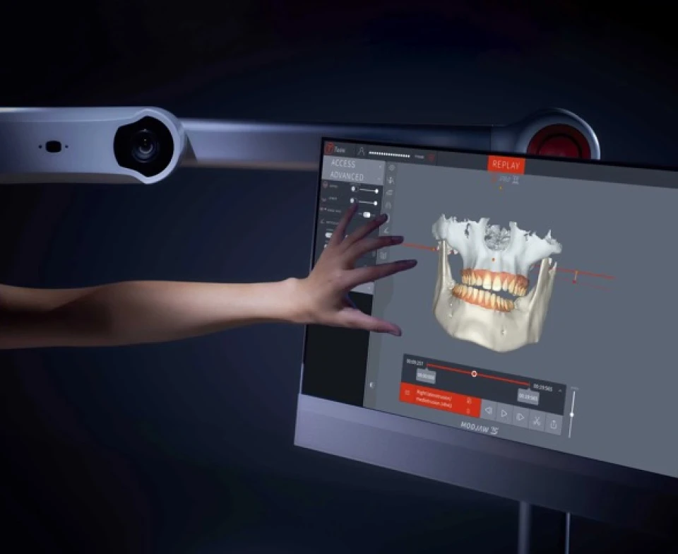 Enregistrement dynamique de l’occlusion avec Modjaw en dentisterie numérique à Apolline Dental Care à Corbeil-Essonnes